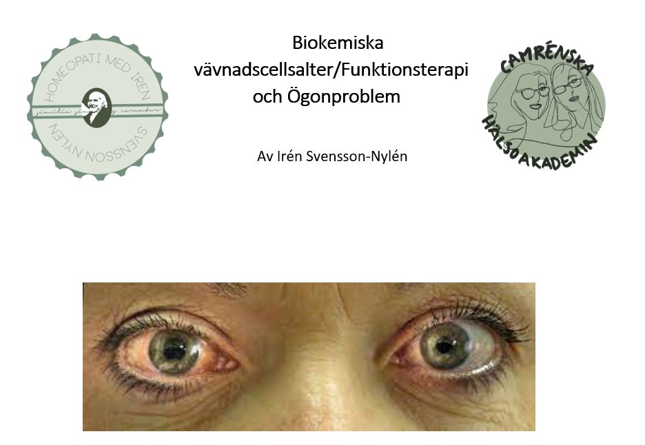 Biokemiska cellsalter och ögonproblem