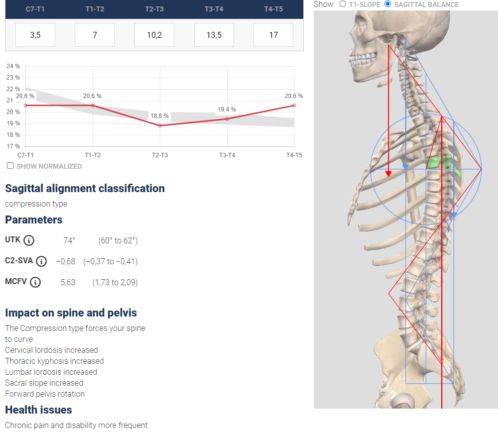 Assessment of sagittal alignment